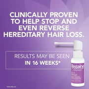 Regaine for Women Regular Strength 2% Minoxidil Scalp Solution – 60ml