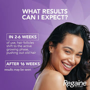 Regaine for Women Regular Strength 2% Minoxidil Scalp Solution – 60mlv